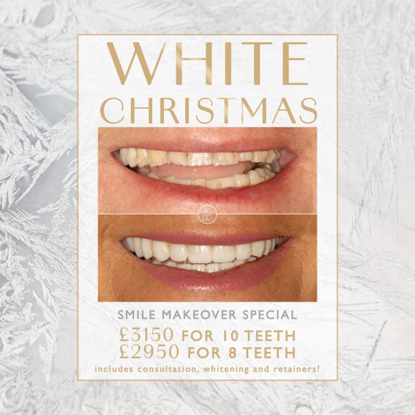 Blog -Auckland Cosmetic Dental Clinic