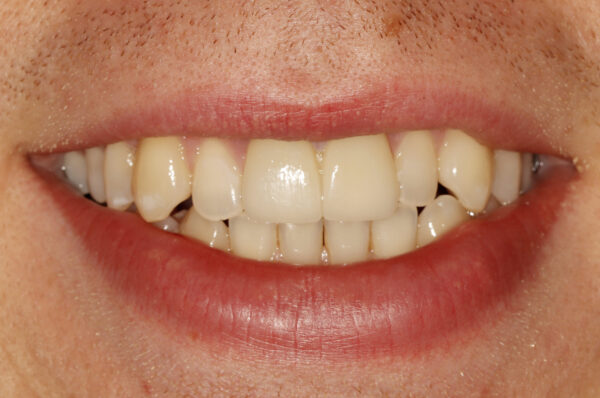 After -Auckland Cosmetic Dental Clinic
